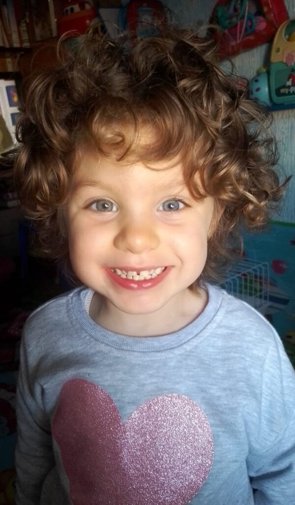 Mi hija tiene parálisis braquial obstétrica y sindrome de Horner